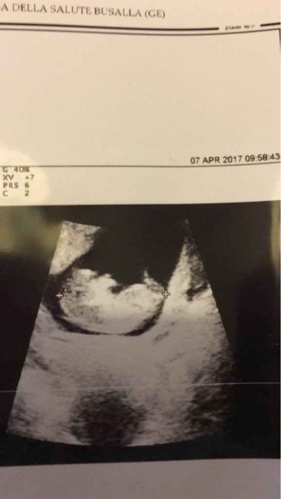 Fagiolino continua a crescere *.* - 3