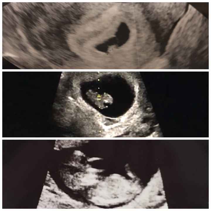 Prima visita...triste - 1