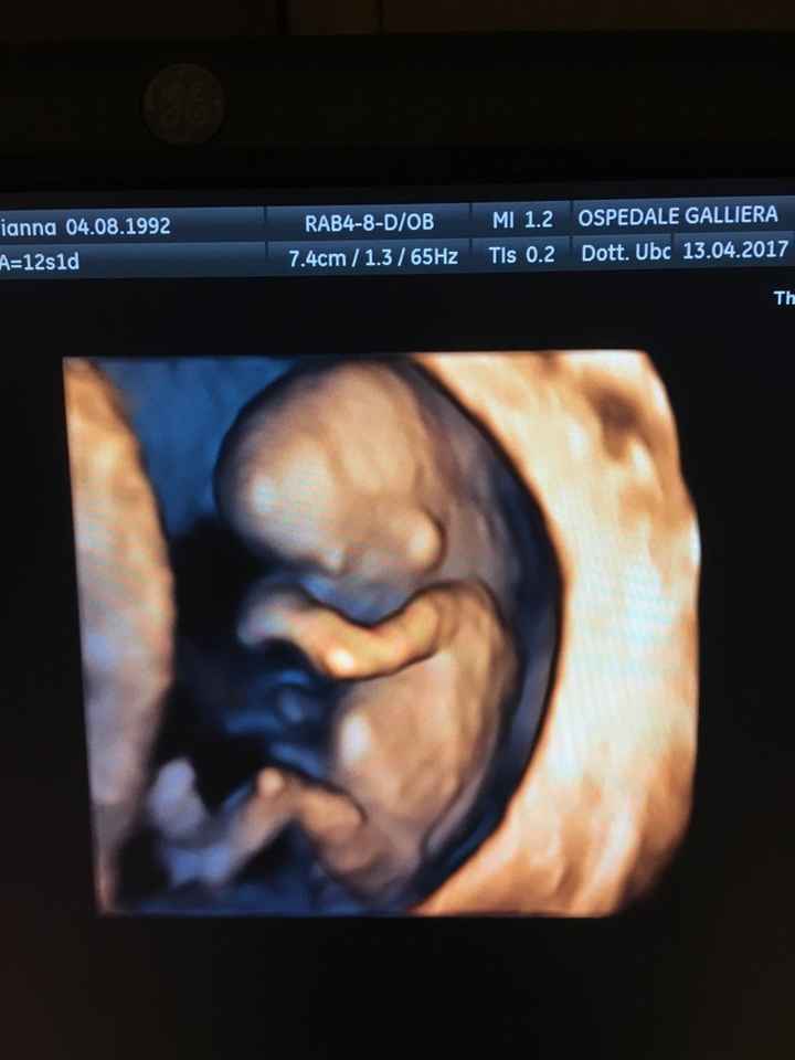 Bi test fatto *.* emozione a mille *.* - 4