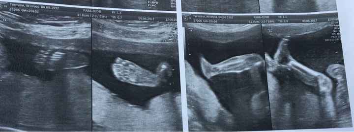 Morfologica, la nostra piccola dispettosa  sara ❤️😍 - 1