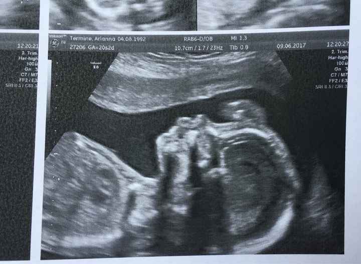 Morfologica, la nostra piccola dispettosa  sara ❤️😍 - 2