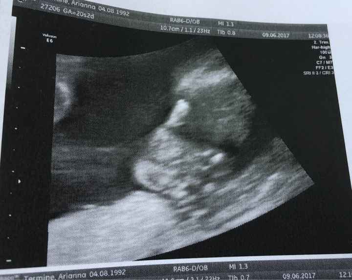 Morfologica, la nostra piccola dispettosa  sara ❤️😍 - 3