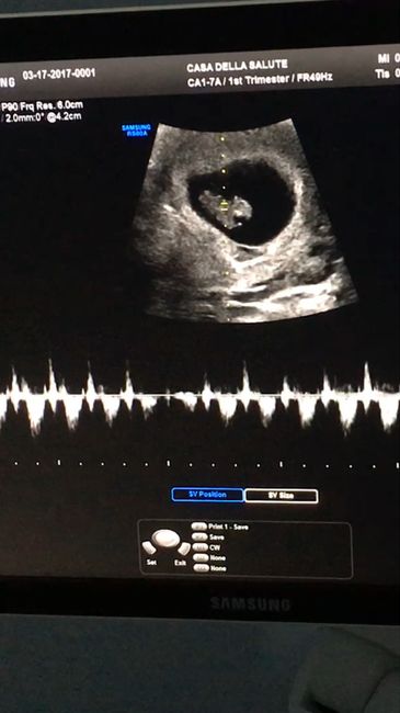 Ecco il mio fagiolino *.* - 2