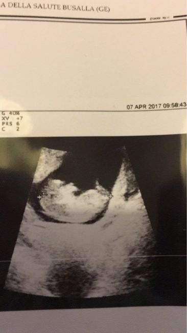 Fagiolino continua a crescere *.* - 3