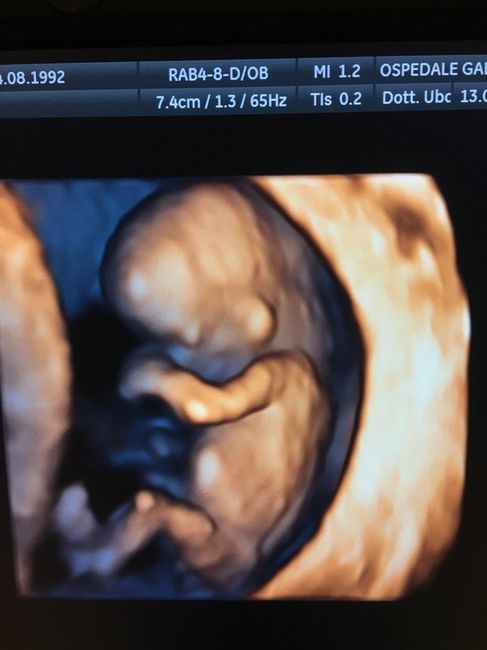 Bi test fatto *.* emozione a mille *.* - 5