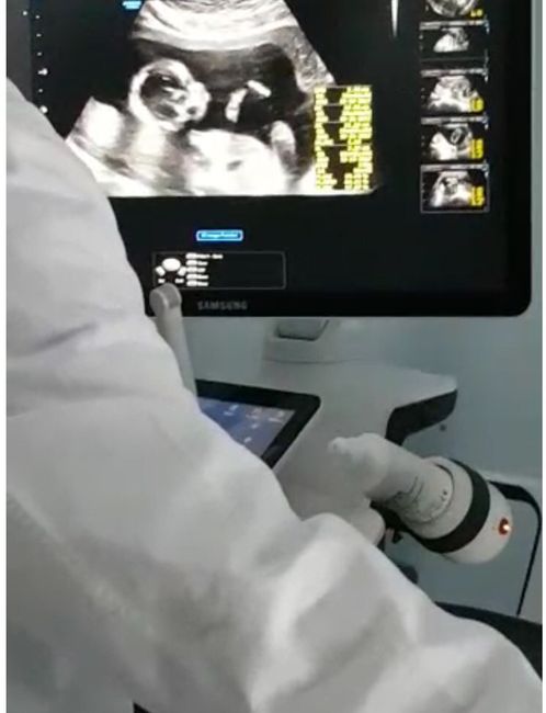 Confermato è una principessina ❤️❤️❤️ - 4