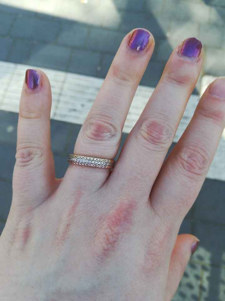 Mi fate vedere il vostro anello della proposta?? - 1