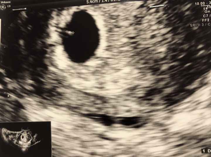 Future mamme di novembre - 1