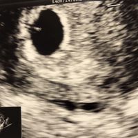 Future mamme di novembre - 1