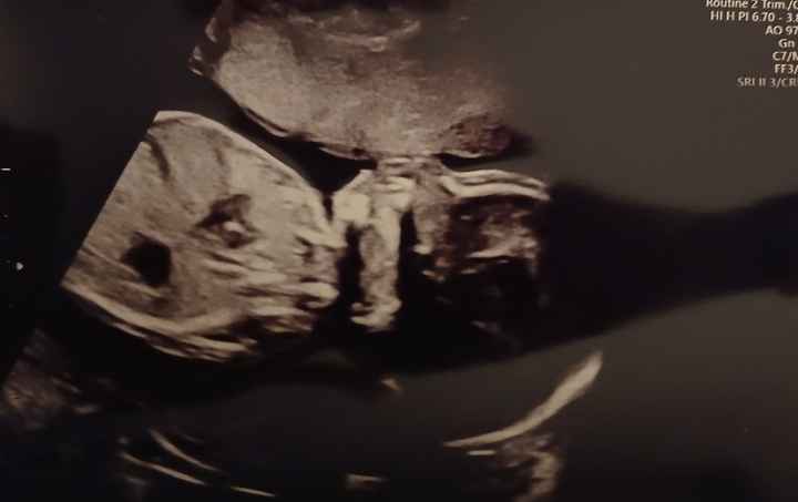 Future mamme febbraio/marzo/aprile 2026 🌸🌼🌿🌾 - 1