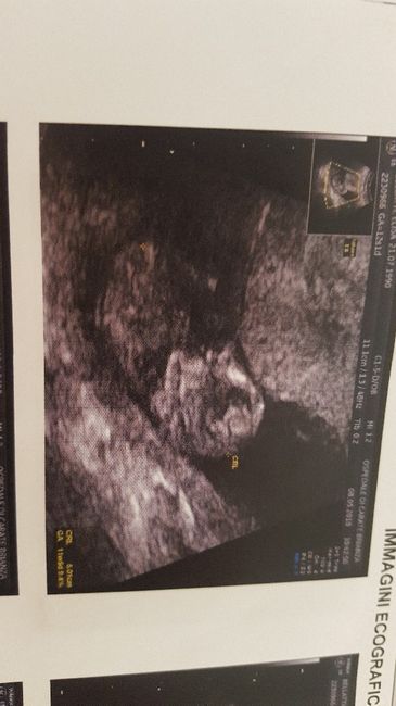 Future mamme di novembre - 1