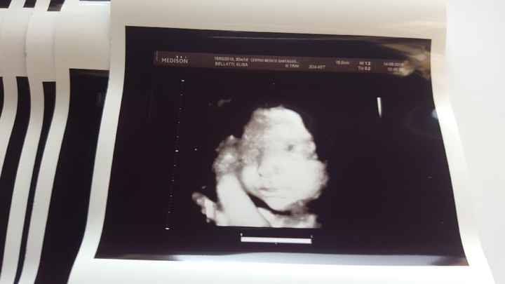 Mammine di novembre - 1