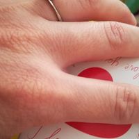 E ora mostraci una foto del tuo anello di fidanzamento! - 1