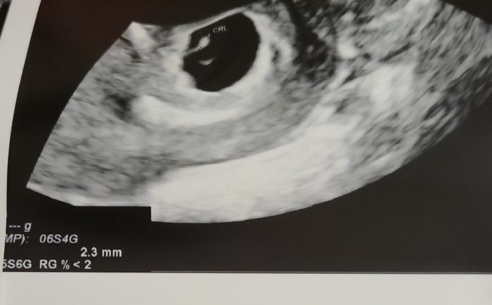 Future mamme Dicembre 2022 1