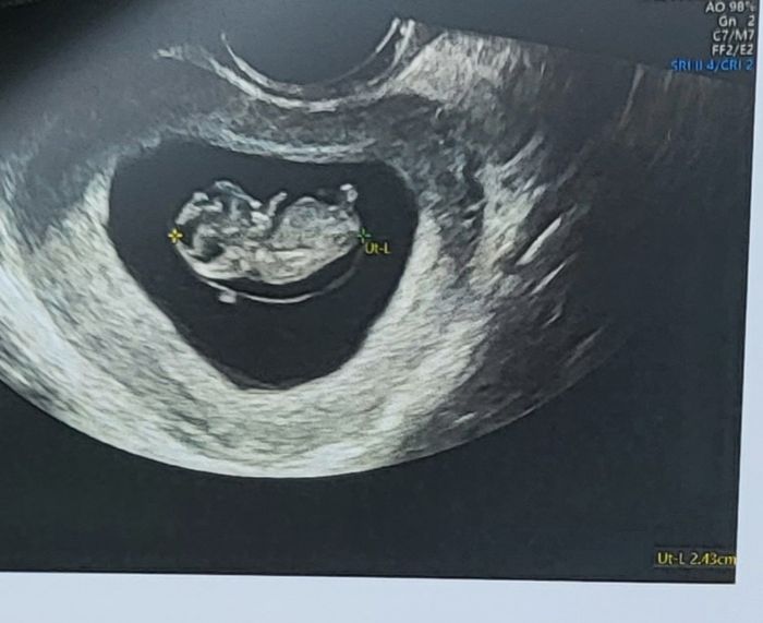 Future mamme Dicembre 2022 3