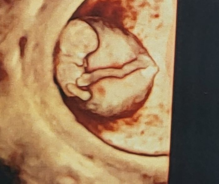 Future mamme Dicembre 2022 4