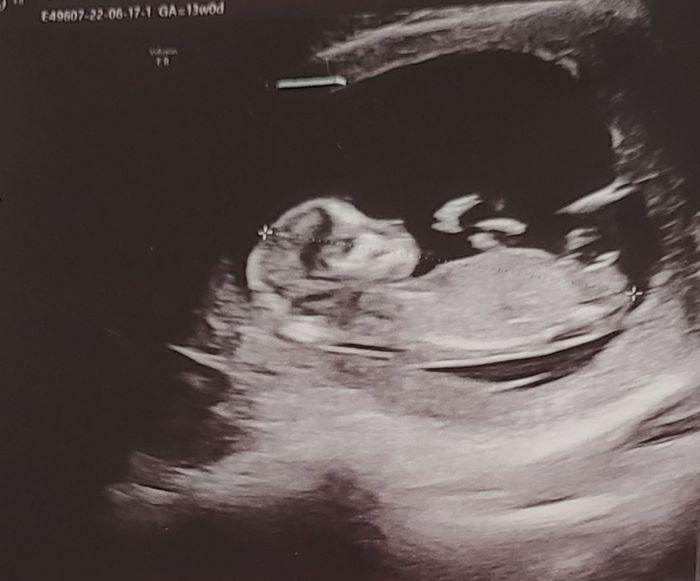 Future mamme Dicembre 2022 3