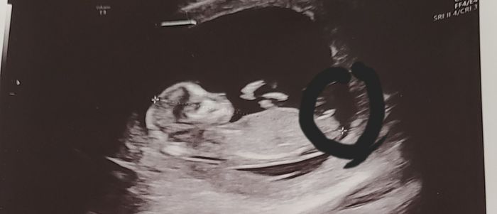 Future mamme Dicembre 2022 1