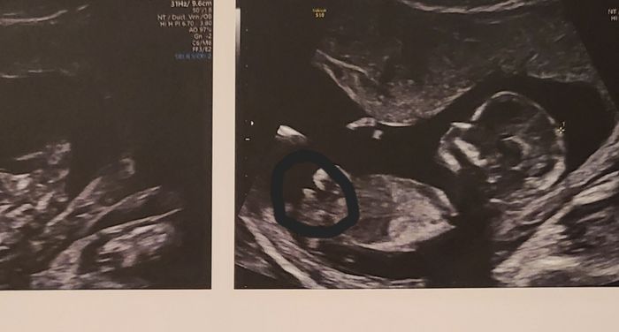Future mamme Dicembre 2022 1