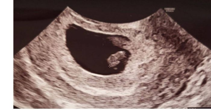 Future mamme febbraio 2023 🍀🙏🏻 2