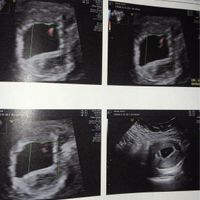 Future Mamme Settembre 2021😍 - 1