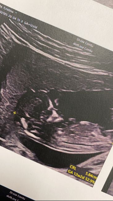 Future mamme di Aprile 2021 🐣 - 2