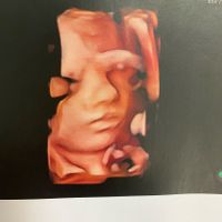 Future mamme di Aprile 2021 🐣 - 1