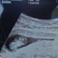 Future mamme ottobre 2020 - 1