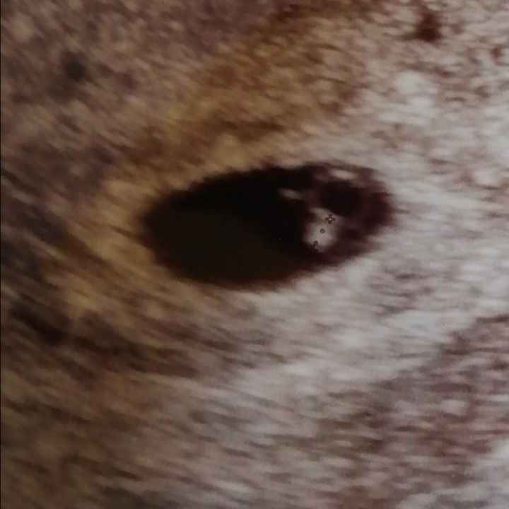 Aiutatemi a capire qst ecografia - 1