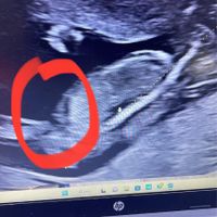 Future Mamme Aprile 2024 - 1