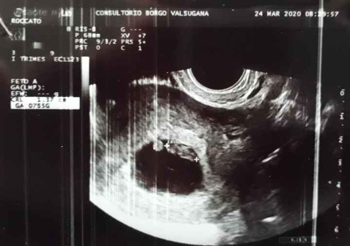 Metodo Ramzi! Chi ci sa azzeccare? - 1