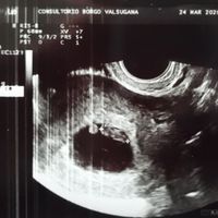 Metodo Ramzi! Chi ci sa azzeccare? - 1