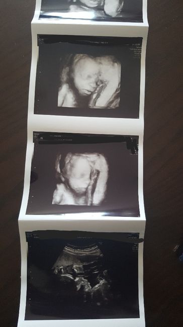 Eco fatta💙💙💙 - 2