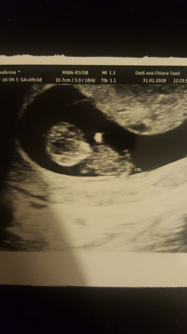 💙💜future mamme di Maggio 2022💙💜 4