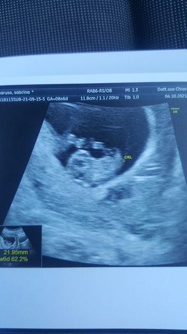 💙💜future mamme di Maggio 2022💙💜 5