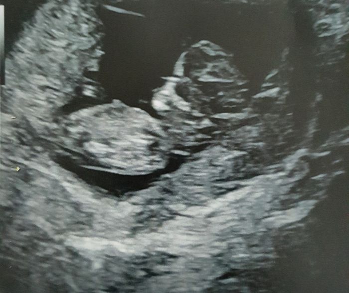 💙💜future mamme di Maggio 2022💙💜 1