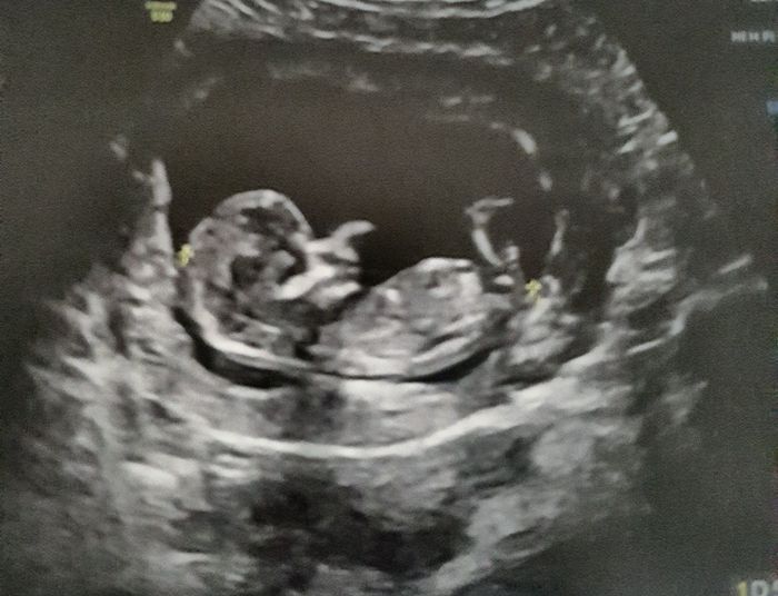 Future mamme Dicembre 2021 🎄🎁💙🎀 - 1