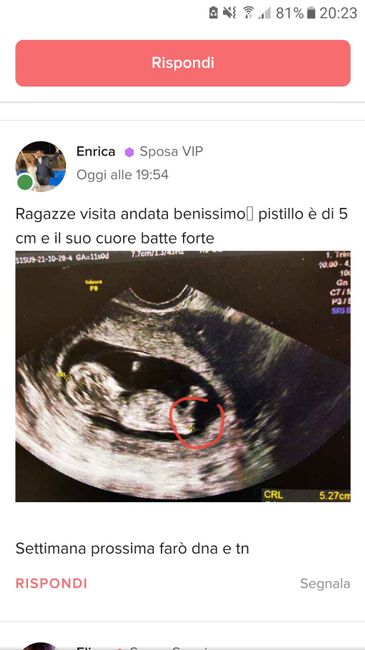 💙💜future mamme di Maggio 2022💙💜 - 1