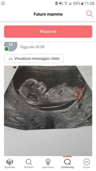 💙💜future mamme di Maggio 2022💙💜 - 1