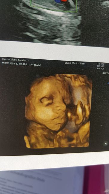 💙💜future mamme di Maggio 2022💙💜 - 2