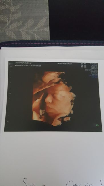 💙💜future mamme di Maggio 2022💙💜 - 1