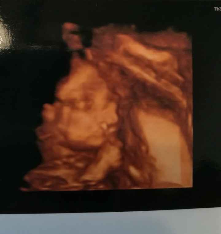 Mamme di Settembre 2018 - secondo trimestre - 1