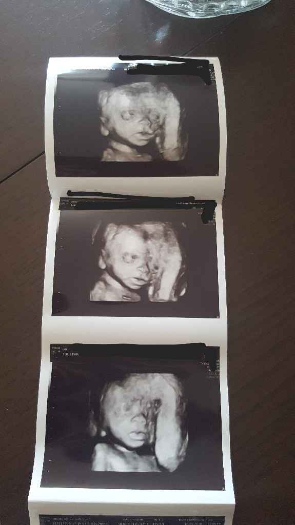 Eco fatta💙💙💙 - 1