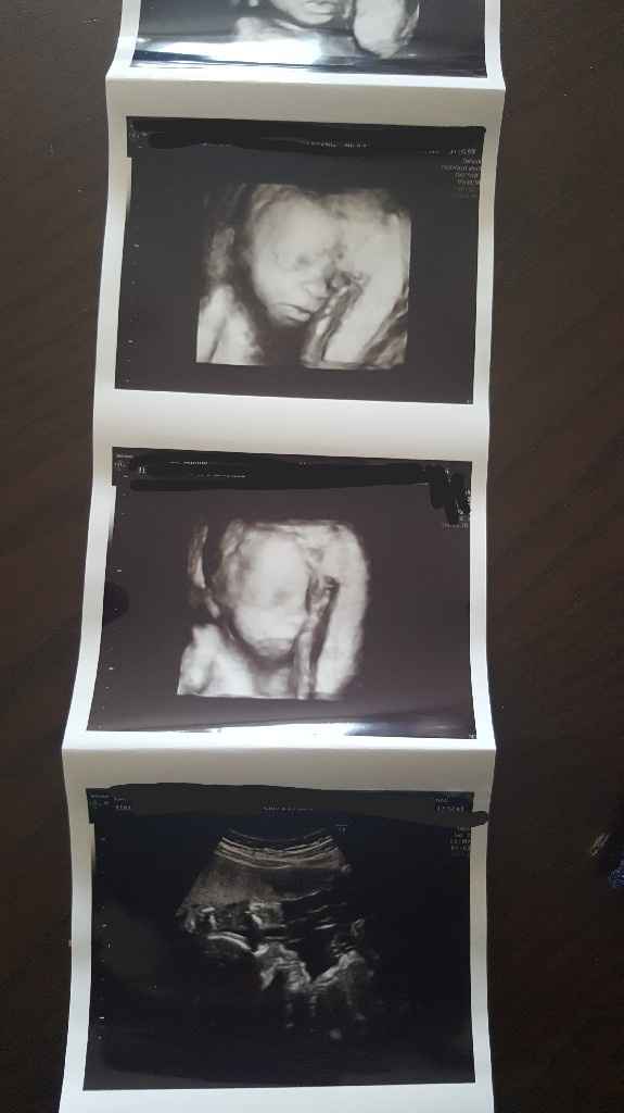 Eco fatta💙💙💙 - 2