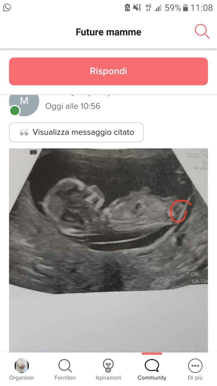 💙💜future mamme di Maggio 2022💙💜 - 1