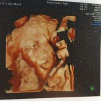 💙💜future mamme di Maggio 2022💙💜 - 3