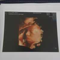 💙💜future mamme di Maggio 2022💙💜 - 1