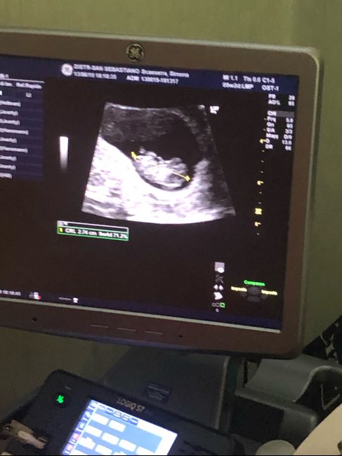 Secondo voi maschio o femmina? 1