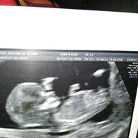 L'amore della mia vita - 1