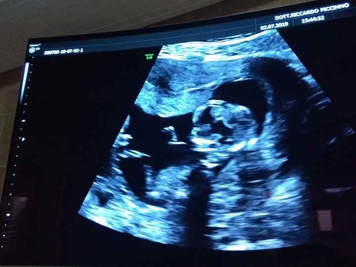 Provo anche io Metodo Ramzi - 2